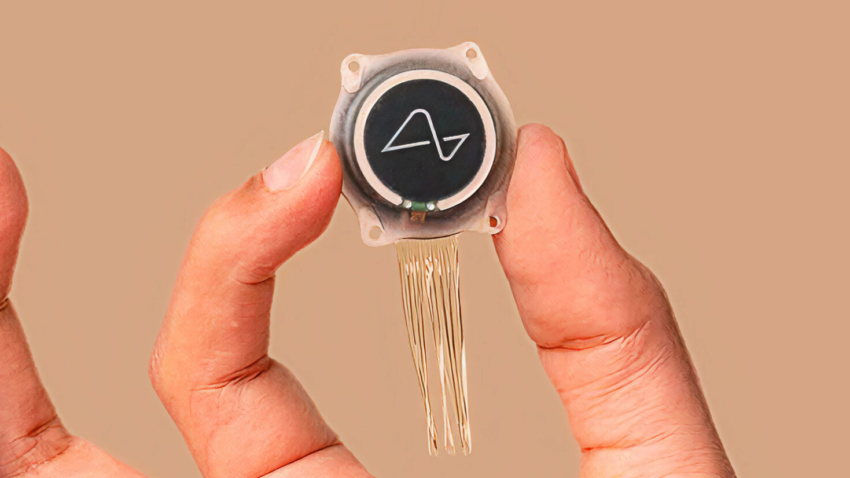 Neuralink Trials Hit The UK